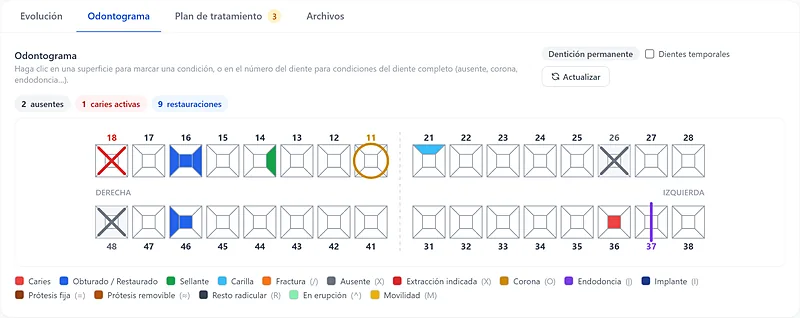Odontograma digital con condiciones por diente como caries, restauraciones, corona y endodoncia en GVentas Plus